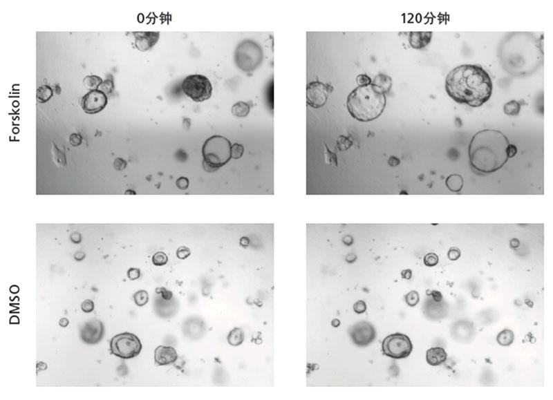 Brightfield microscopy image of intestinal organoids treated with forskolin or with DMSO.