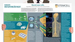 Neural Stem Cells