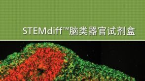 STEMdiff&trade;脑类器官试剂盒