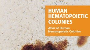 Atlas of Human Hematopoietic Colonies 