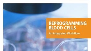 血细胞重编程的完整流程