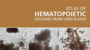 Atlas of Hematopoietic Colonies From Cord Blood