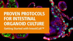 Proven Protocols for Intestinal Organoid Culture: Getting Started with IntestiCult™