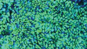 STEMCELL Technologies Applauds Feeder-free Derivation of Human Induced Pluripotent Stem Cells