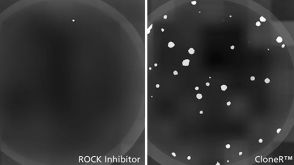 STEMCELL Technologies to Launch CloneR™ to Facilitate Genome Editing of  Human Pluripotent Stem Cells