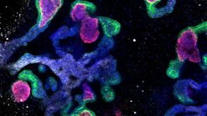 STEMCELL Technologies Signs Exclusive License to Commercialize Human Pluripotent Stem Cell-Derived Kidney Organoid Culture System