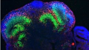 EMBL Organoids 2016 Conference