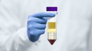 如何从全血制备白膜层？