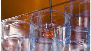 样本使用HetaSep™去除红细胞后如何计算用于集落检测的细胞铺板浓度