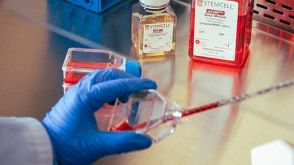 Transitioning from Feeder-Free Media to mTeSR™ Plus for Human Pluripotent Stem Cell Culture