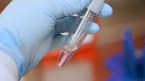 Enzyme-Free Passaging of Human Pluripotent Stem Cells Using ReLeSR™