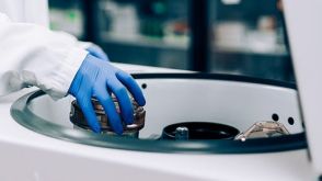 如何使用DNase I减少单细胞悬液中的细胞团块