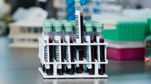 如何从存放时间较长的血液样本去除粒细胞？