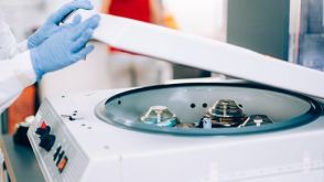 如何冻存外周血单个核细胞(PBMCs)?