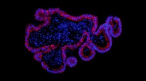 How to Establish Intestinal Organoid Culture from Isolated Mouse Intestinal Crypts