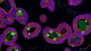 如何使用 IntestiCult™ 培养小鼠肠类器官衍生的单层肠上皮