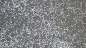 Enzymatic Dissociation of Adult Mouse or Rat CNS Tissue into Single-Cell Suspension