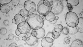 Cryopreserving Human Liver Tissue for Organoid Culture