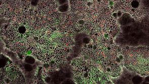 使用HepatiCult™ Organoid Initiation Medium（人）从3D类器官建立单层培养体系