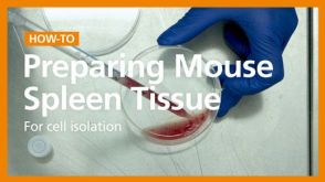 How to Prepare a Single-Cell Suspension from Mouse Spleen Prior to Dendritic Cell Isolation