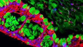 Barrier Permeability Assay Using Human Intestinal Organoid-Derived Monolayers