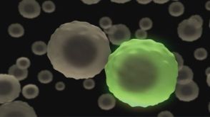How to Identify ALDH-Expressing Cells in Human Breast Tissue