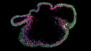How to Prepare Single Cells from PSC-Derived Epithelial Cultures for Flow Cytometry Analysis