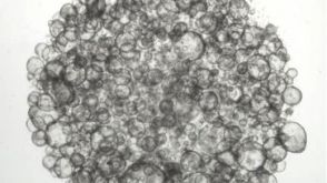 使用IntestiCult™ 将肠类器官传代至悬浮培养