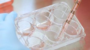 How to Generate Monocyte-Derived Dendritic Cells