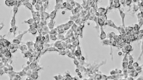 How to Co-Culture Human Airway Epithelial and Immune Cells for RSV Infection