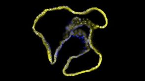 Drug Screening with Human Pancreatic Organoid Cultures