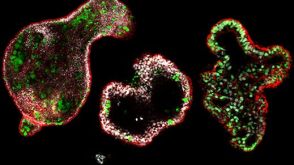 How to Differentiate hiPSCs into Colonic Organoids Using STEMdiff™