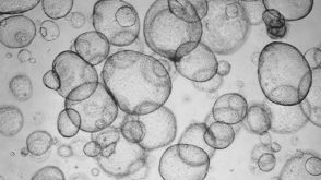 Detection of CYP3A4 Activity in Human Hepatic Organoids by LC-MS
