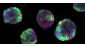 How to Generate hPSC-Derived 3D Kidney Organoids Using STEMdiff™