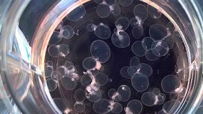 How to Extract CSF-Like Fluid from Choroid Plexus Organoids