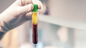 How to Collect Plasma from Whole Blood Before Cell Isolation