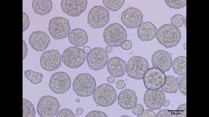 Differentiation of hPSCs to Ventricular Cardiomyocytes in 3D Culture