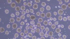 How to Differentiate hPSCs to Lymphoid-Competent CD34+ Hematopoietic Stem and/or Progenitor Cells Using a Scalable Suspension Protocol