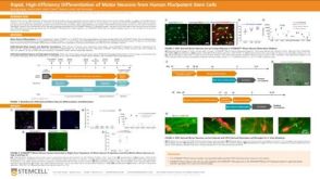 Rapid, High-Efficiency Differentiation of Motor Neurons from Human Pluripotent Stem Cells
