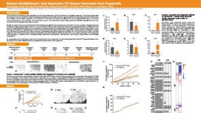 Robust Establishment and Expansion of Human Pancreatic Duct Organoids