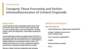 Cryogenic Tissue Processing and Section Immunofluorescence of Cerebral Organoids