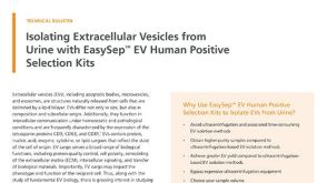 Isolating Extracellular Vesicles from Urine with EasySep™ EV Human Positive Selection Kits