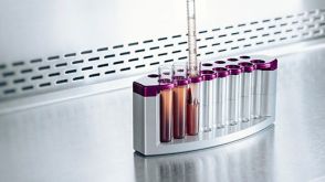 Simplify Your PBMC Isolations with the EasySep™ Direct Human PBMC Isolation Kit
