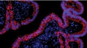 Mouse Intestinal Organoid Course