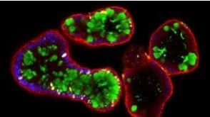 Human Intestinal Organoid Course