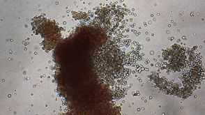 Human Hematopoietic CFU Assay Course