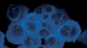 CD138⁺ Cell Isolation Course