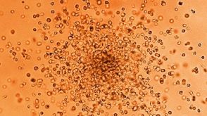 Introduction to STEMvision for CFU Assay Scoring Course