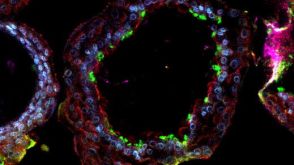 FAQs on Human Airway Organoid Cultures