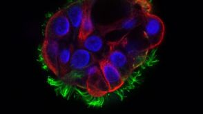 Frequently Asked Questions on PneumaCult™ Apical-Out Airway Organoid Medium